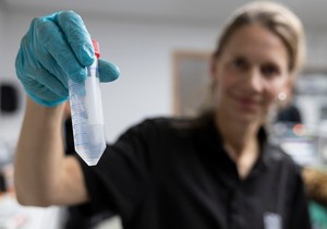 Donor sperme imao genetsku mutaciju koja izaziva rak