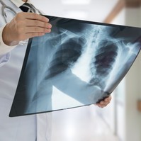 Az orvos elárulja, hogy mit tegyen a COPD-s beteg, ha fellángolnak a tünetei