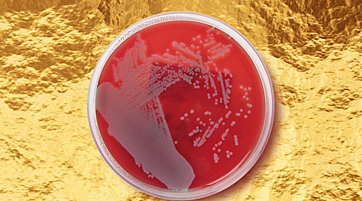 A multirezisztens szuperbaktériumok, köztük a képünkön is látható Staphylococcus aureus, az egyik legnagyobb fenyegetést jelentik az emberiség számára. Hosszú ideje nem sikerült már új hatásos gyógyszert kifejleszteni ellenük, és lassan kifogyunk a lehetőségekből. Egy új kutatás azonban az aranyvegyületekben találta meg azt a fegyvert, amely a jövőben legyőzheti ezeket a halálos mikroorganizmus törzseket.  / Fotó: Nathan Reading / Flickr / NorthFoto