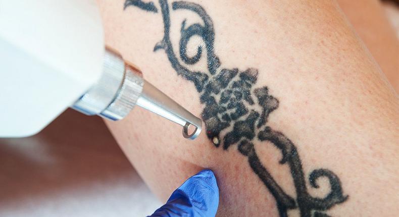 There are creams and balms that promise to lighten or erase a tattoo. 