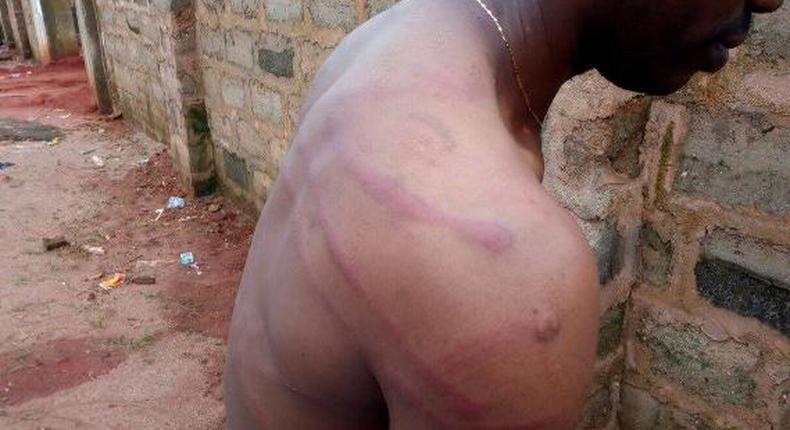 Photos of the brutality meted on the victim by soldiers in Edo state