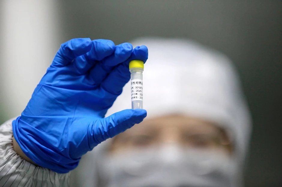 Laboratorije širom sveta rade na ispitivanju virusa