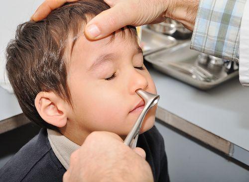 Nosné mandle vedia deti potrápiť, sú častou príčinou detských chorôb |  Najmama.sk