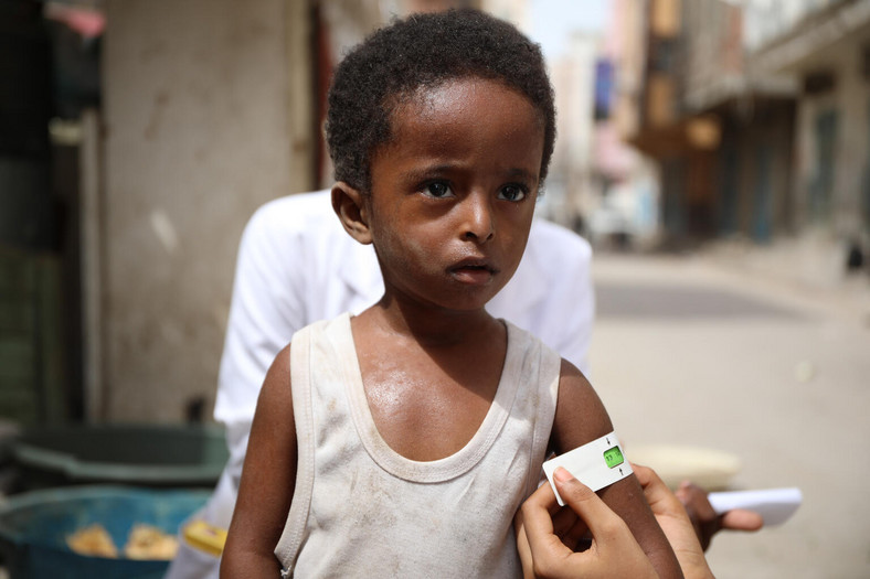 Dziecko w Jemenie
