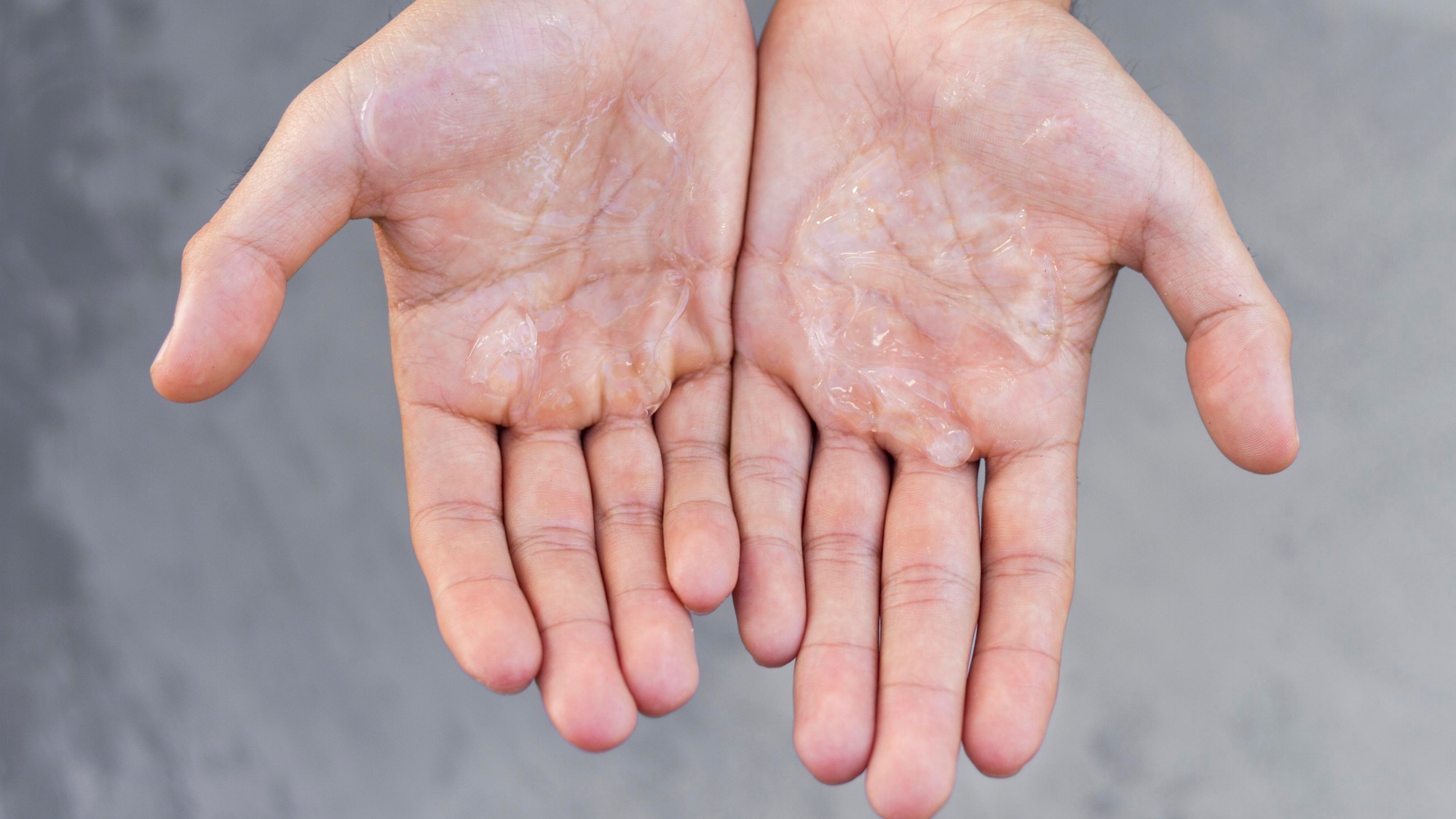 Ako zachrániť suchú pokožku rúk?