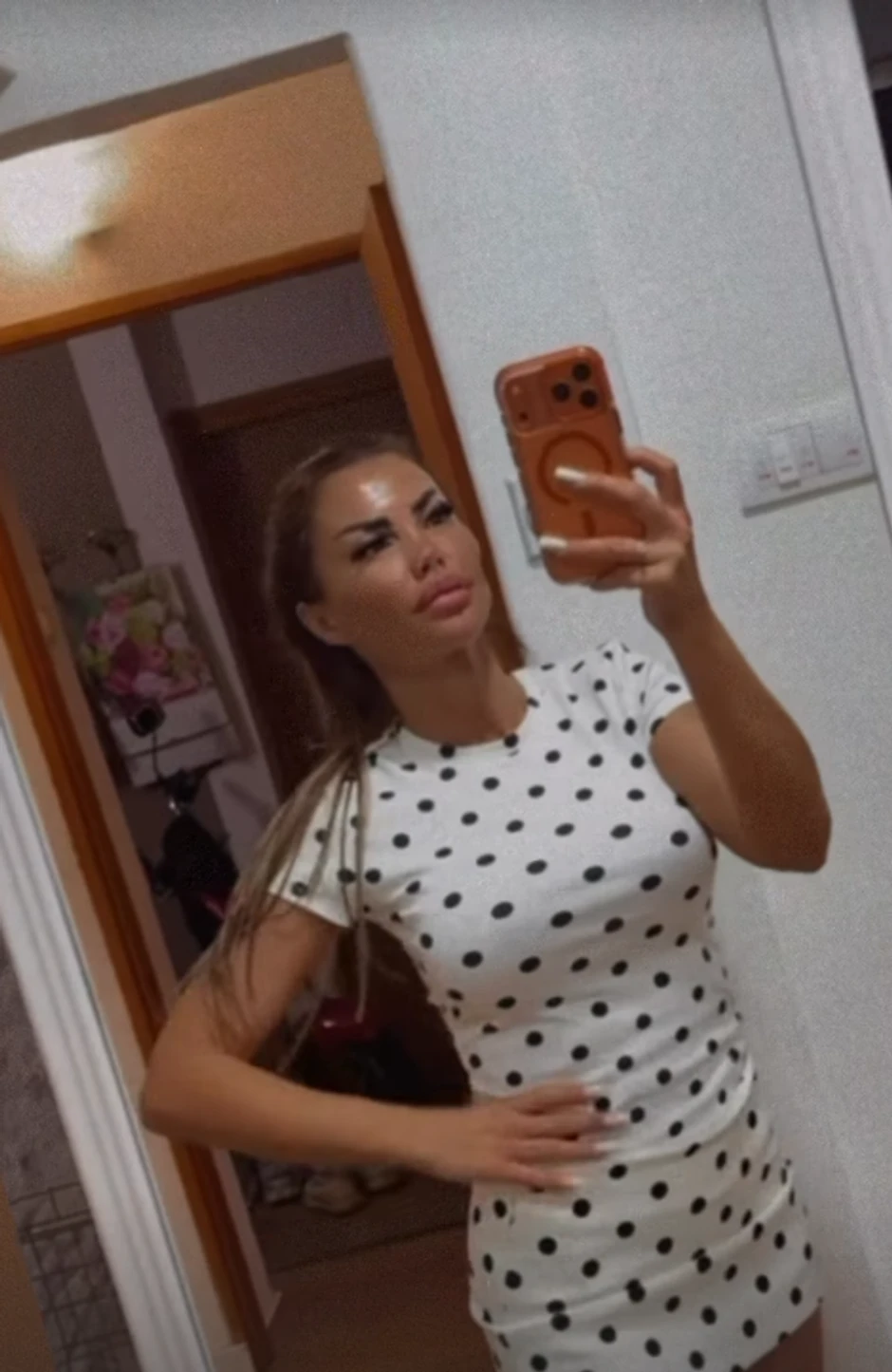 Starleta rodila sina 19 godina starijem, 8 puta operisala nos i pokazala lice