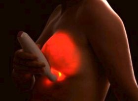 breastlight-d00000A94dbaf33e2614d
