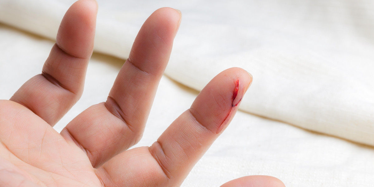 Rozcięcie palca kartką może przyczynić się do złapania poważnej infekcji