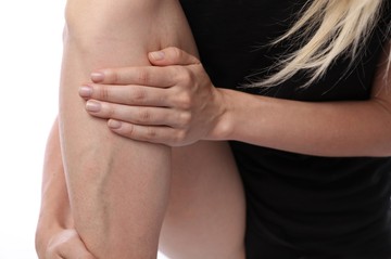 Visszerek a lábon: mikor kell vele feltétlen orvoshoz fordulni?