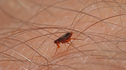 Is the human flea dangerous?