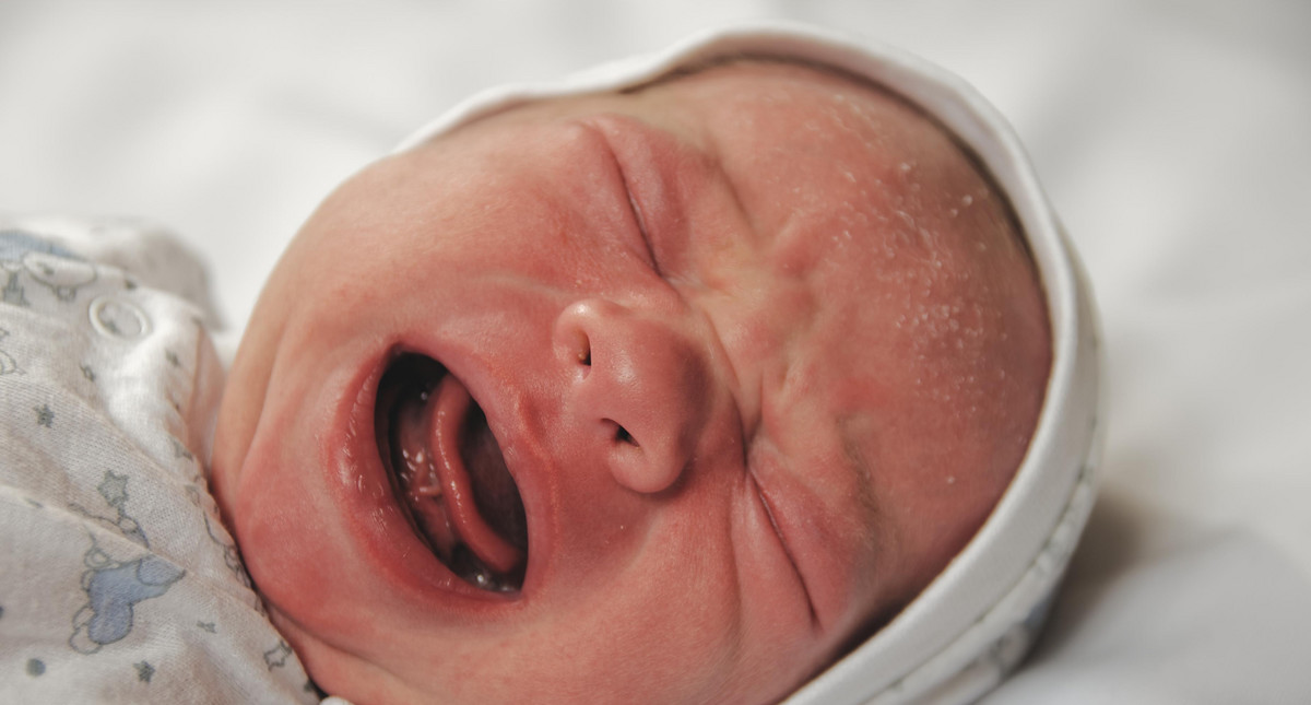 Ciemieniucha u niemowlaka - przyczyny, leczenie. Jak się pozbyć ciemieniuchy?  [WYJAŚNIAMY]