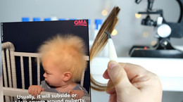 Syndrom nieuczesanych włosów to bardzo rzadkie, niegroźne schorzenie (Fot. YouTube/@GMA)