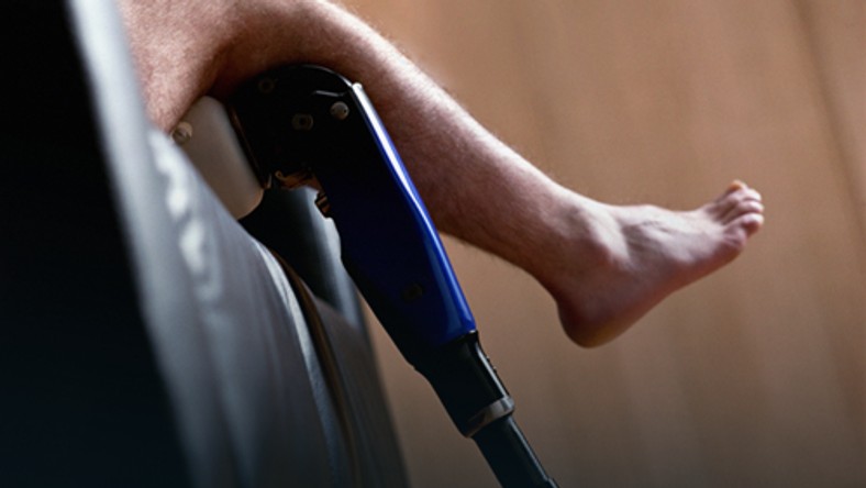 Amputacja nogi forum