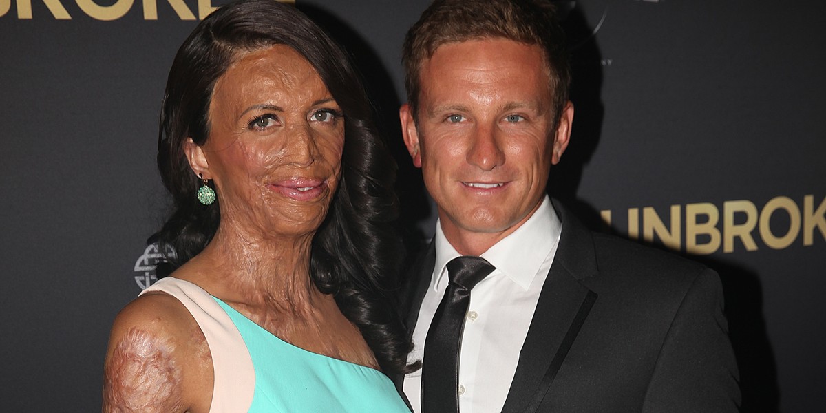 Turia Pitt, Michael Hoskin