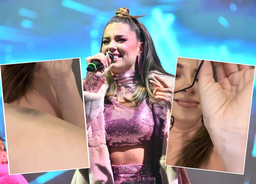 Sara Jo dobila modrice nakon pada