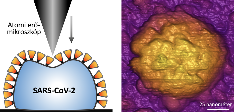 Nagyon ellenálló a vírus /Fotó: Semmelweis.hu/