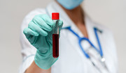 Badania krwi - ile kosztują? Kiedy wykonać badania krwi?