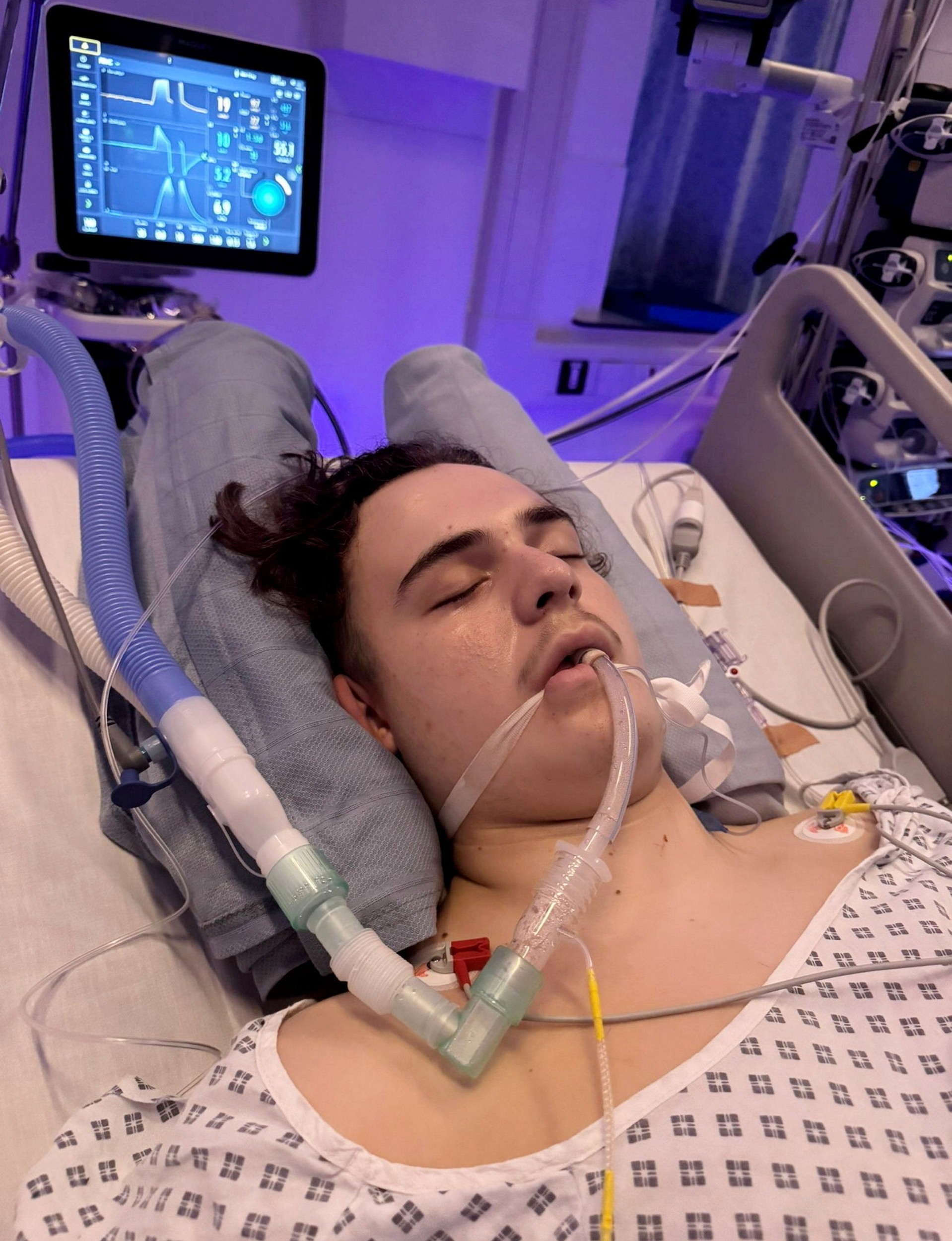 Štrnásťročnému Maxovi diagnostikovali terminálny nádor na mozgu.