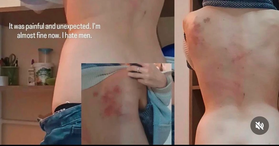 Prebijena Ruskinja u Beogradu