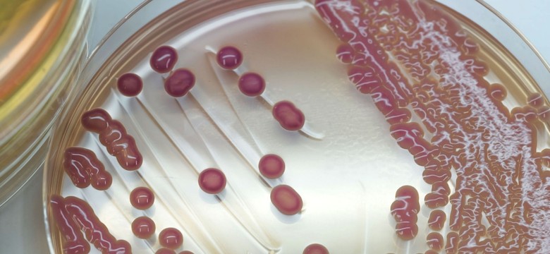 Na Pomorzu pojawiła się "superbakteria", odporna na wszystkie antybiotyki. Co na to Sanepid?