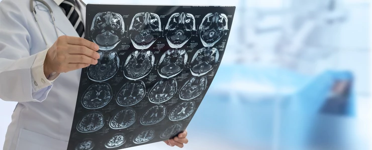 Ljudski mozak raste tokom generacija, pokazuje istraživanje američkih neurologa