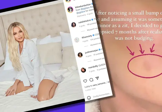 Khloe Kardashian miała nowotwór. Teraz apeluje do fanów: "Nikt nie ma taryfy ulgowej"