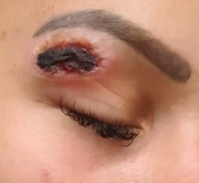 Samo jedna u nizu žena koja je tretman radila u ovom salonu 