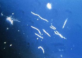 borrelia-lyme-kor-d0000108Ef8d1c3d6d150