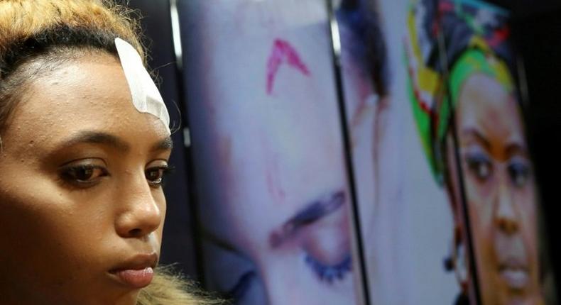 South African model Gabriella Engels has accused Zimbabwe's First Lady Grace Mugabe of beating her with an electrical extension cable at a Johannesburg hotel