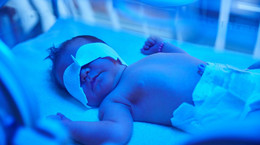 Żółtaczka u noworodka - charakterystyka i przyczyny
