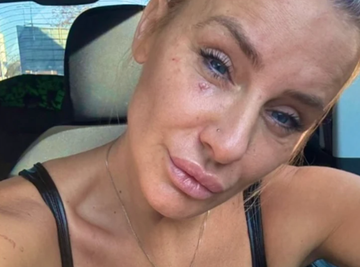 "OD JUTRA DO MRAKA U BOLOVIMA!" Milica Dabović OPERISANA ČETVRTI PUT: "Da mi je neko pričao da će trajati 12 dana"