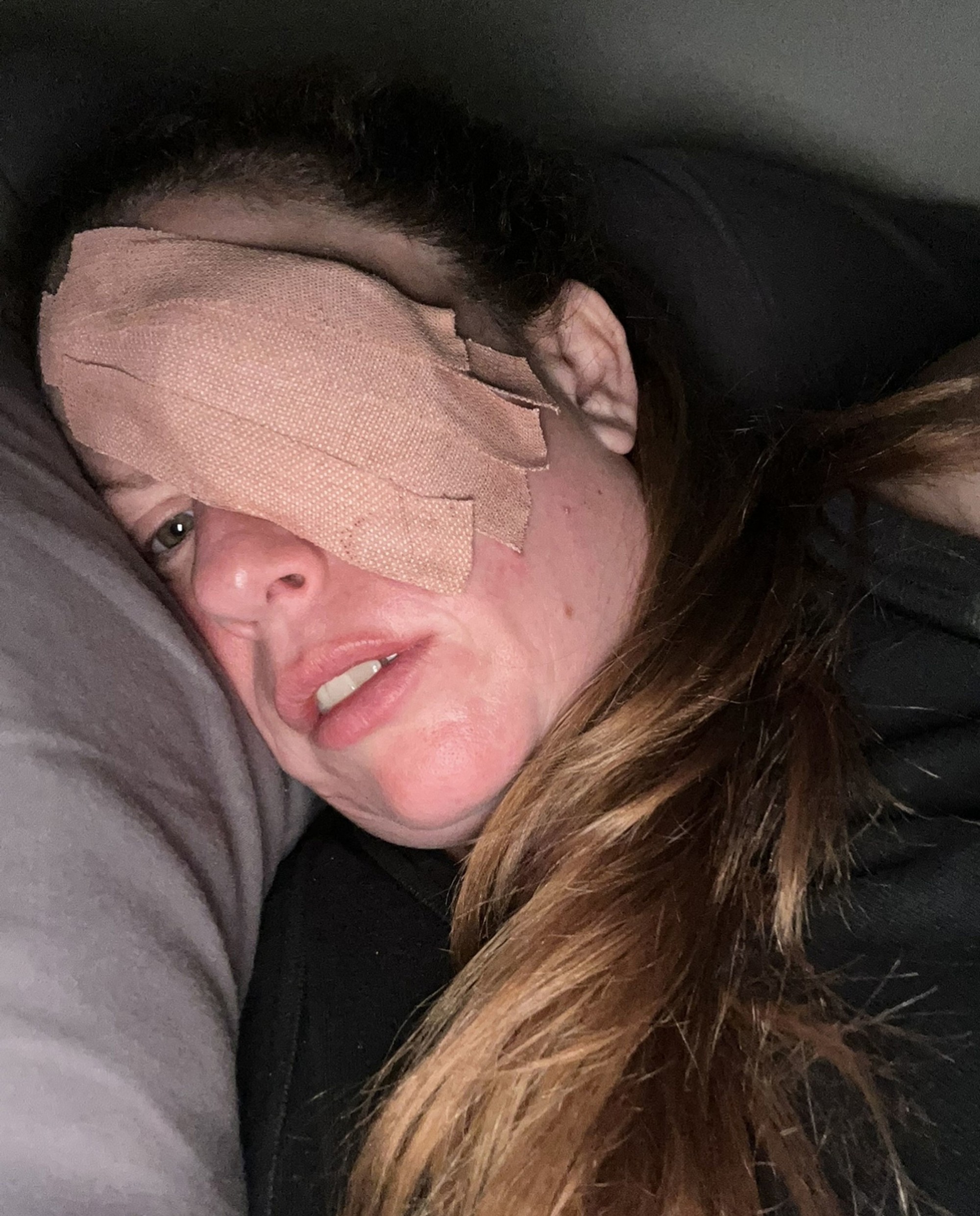 Rakovina mladej mamičke vzala oko.