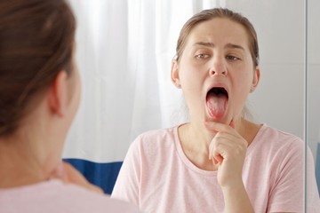 Lepedék a nyelven, dudor a szájban: gombás vagy bakteriális fertőzés jelei?