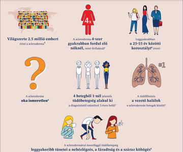 A szisztémás szklerózis, amely scleroderma néven is ismert, egy ritka és gyógyíthatatlanautoimmun betegség, amely a test kötőszöveteit érinti.1,2,3 A betegség során a bőr hegesedik (fibrózis), de a hegesedés más szerveket is érinthet, például a szívet, a tüdőt,az emésztőrendszert, a vesét, és életveszélyes szövődményeket okozhat.