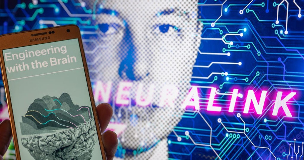 Stało się! Firma Elona Muska wszczepiła chip do mózgu człowieka