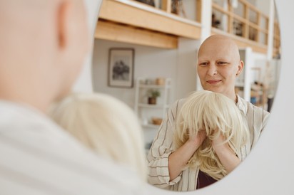 Kemoterápia és hajhullás - ezek a válaszok a betegek leggyakoribb kérdéseire