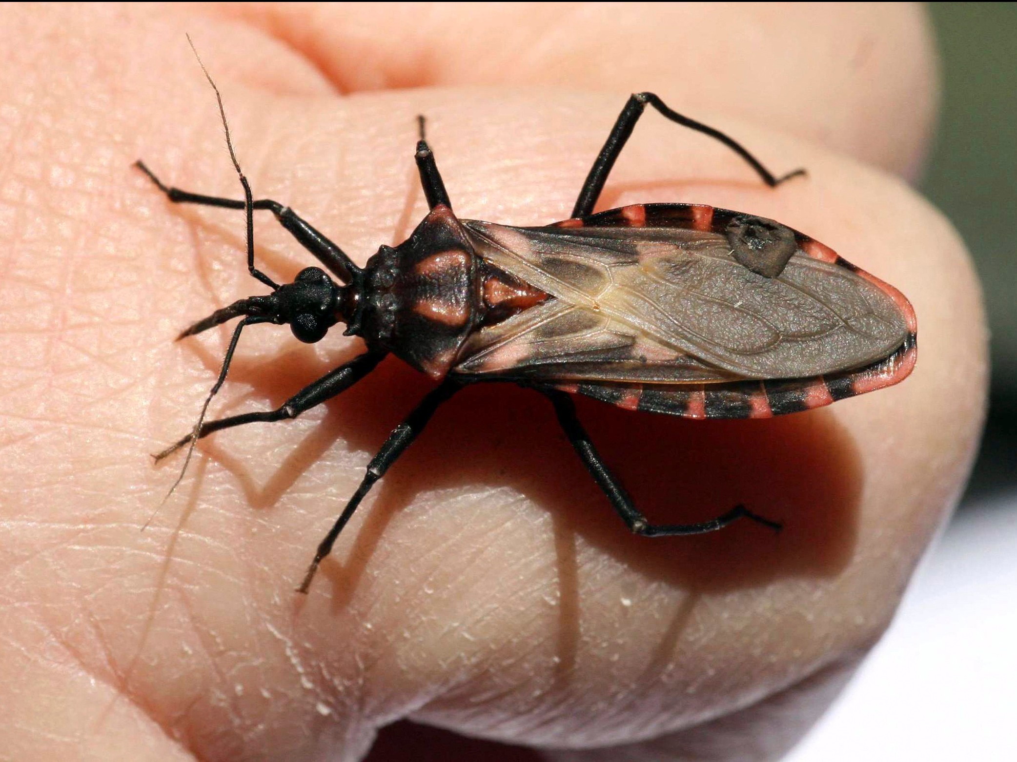 A parasitic illness from 'kissing bugs' that bite your face at night is