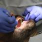 Zęby z probówki. Czy tak będzie wyglądała rewolucja w stomatologii?