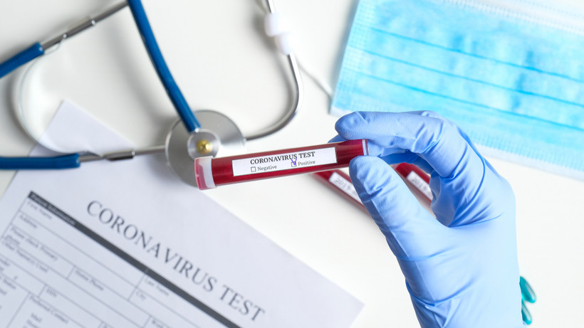 NFZ opublikował zarządzenie m.in. w sprawie rozliczania testów antygenowych i szpitali tymczasowych