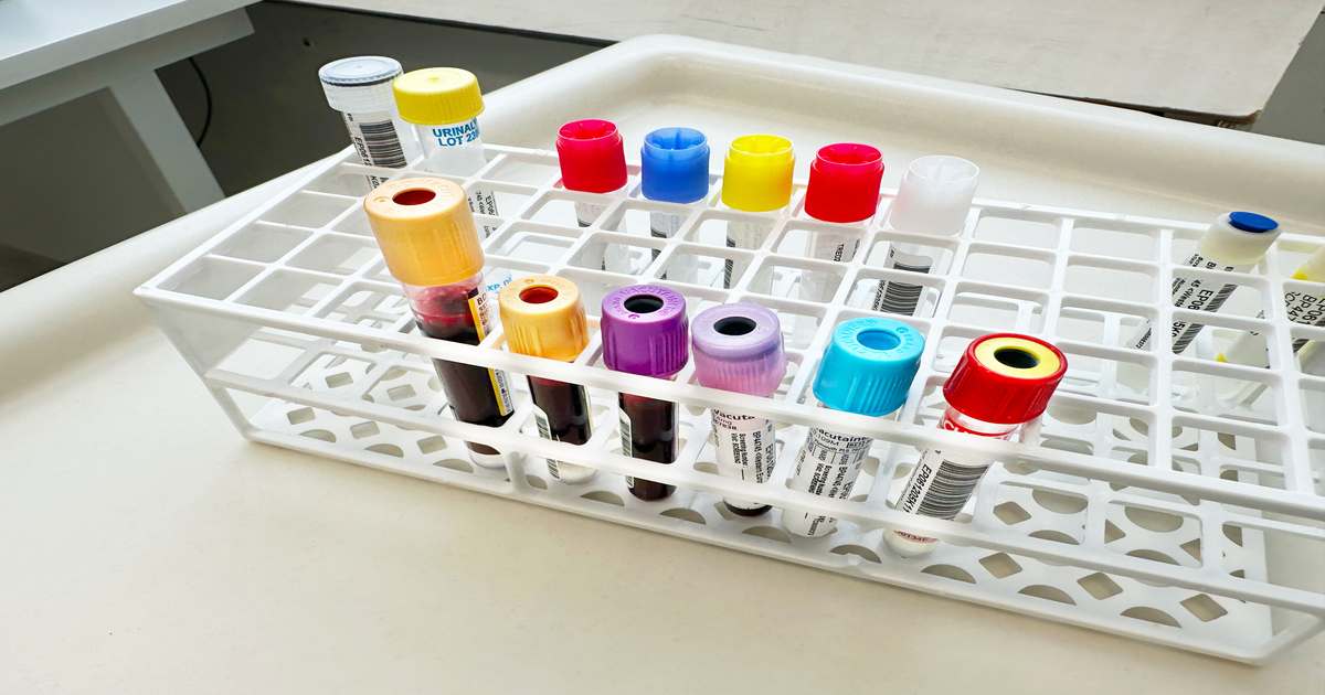 52% meno progressione con nuova terapia tumore seno aggressivo