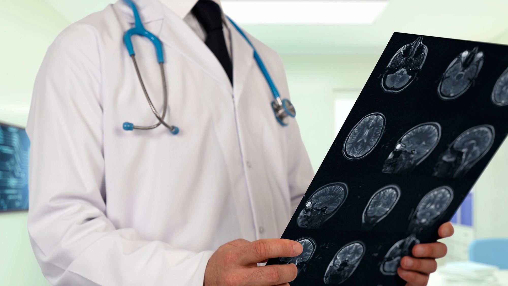 Príznaky rakoviny bývajú často prehliadané alebo zamieňané za iné zdravotné ťažkosti. (ilustračné foto)