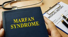 Zespół Marfan - choroba długich i słabych rąk