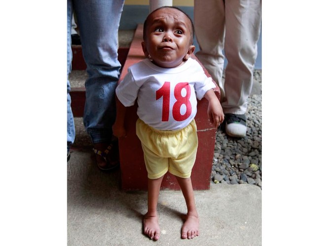 Filipińczyk nie może sam chodzić, nie jest także w stanie zbyt długo samodzielnie stać