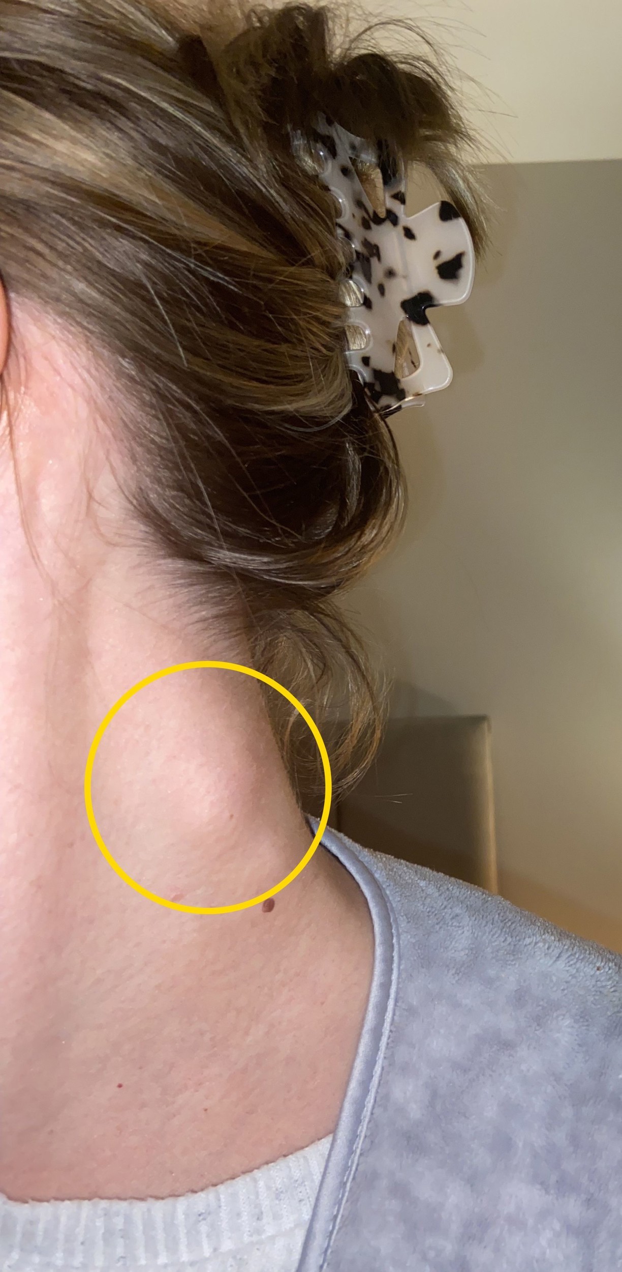 Hollie Thursby odhalila smrteľnú diagnózu vďaka zvláštnej bolesti po víne.