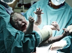 Cesarskie rekordy. "Wysoka liczba cesarskich cięć to nieszczęście"