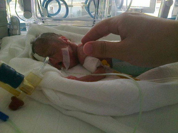 Vuk se rodio sa 470 grama i niko nije ni slutio da će ova heroj-beba preživeti