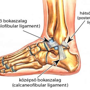 Mi az ínszalagszakadás?