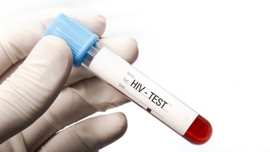 Dżakarta: bez testu na HIV nie ma zgody na ślub