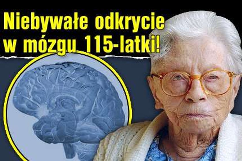 Niebywałe odkrycie w mózgu 115-latki!