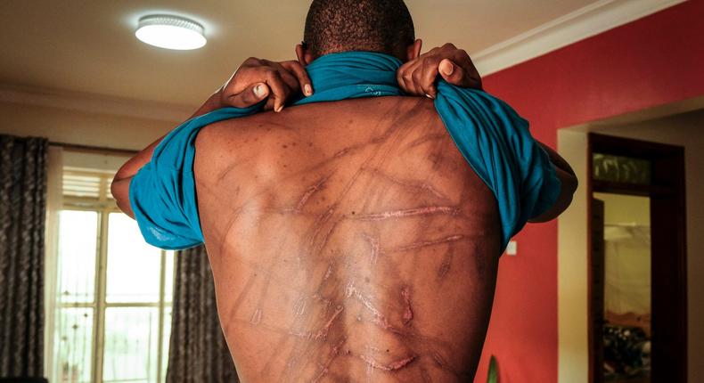 Kakwenza body bears marks allegedly caused by torture 